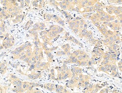 Invitrogen CHMP2A Polyclonal Antibody 100 μL; Unconjugated:Antibodies,