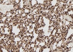 DSS1 Polyclonal Antibody:Antibodies, Polyclonal