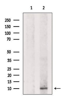 DSS1 Polyclonal Antibody:Antibodies, Polyclonal