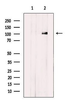 Invitrogen ELAC2 Polyclonal Antibody 100 &mu;L; Unconjugated:Antibodies,
