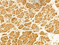 Invitrogen&trade;&nbsp;MICAL1 Polyclonal Antibody