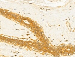 Invitrogen&trade;&nbsp;MICAL1 Polyclonal Antibody