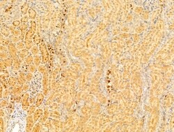 Invitrogen PEX16 Polyclonal Antibody 100 &mu;L; Unconjugated:Antibodies,