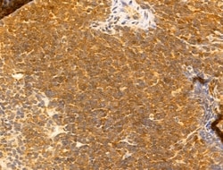 Invitrogen SYNPO2 Polyclonal Antibody 100 μL; Unconjugated:Antibodies,
