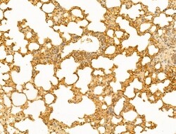 Invitrogen SYNPO2 Polyclonal Antibody 100 μL; Unconjugated:Antibodies,