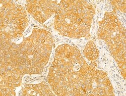 Invitrogen STX11 Polyclonal Antibody 100 μL; Unconjugated:Antibodies,