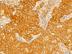 Invitrogen STX11 Polyclonal Antibody 100 μL; Unconjugated:Antibodies,