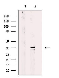 Invitrogen STX11 Polyclonal Antibody 100 μL; Unconjugated:Antibodies,