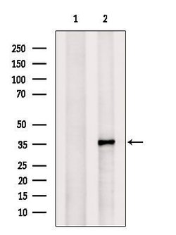 Invitrogen STX11 Polyclonal Antibody 100 μL; Unconjugated:Antibodies,