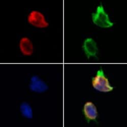 Invitrogen TAF12 Polyclonal Antibody 100 &mu;L | Buy Online | Invitrogen&trade; | Fisher Scientific