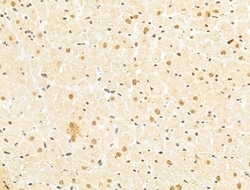 Invitrogen TAF12 Polyclonal Antibody 100 &mu;L | Buy Online | Invitrogen&trade; | Fisher Scientific