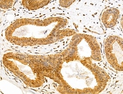 Invitrogen TAF12 Polyclonal Antibody 100 &mu;L | Buy Online | Invitrogen&trade; | Fisher Scientific