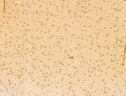 Invitrogen TAF12 Polyclonal Antibody 100 &mu;L | Buy Online | Invitrogen&trade; | Fisher Scientific