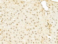 Invitrogen TAF12 Polyclonal Antibody 100 &mu;L | Buy Online | Invitrogen&trade; | Fisher Scientific