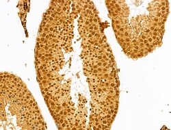 Invitrogen TAF12 Polyclonal Antibody 100 &mu;L | Buy Online | Invitrogen&trade; | Fisher Scientific