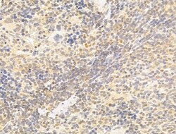 Invitrogen TAF12 Polyclonal Antibody 100 &mu;L | Buy Online | Invitrogen&trade; | Fisher Scientific
