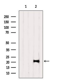 Invitrogen TAF12 Polyclonal Antibody 100 &mu;L | Buy Online | Invitrogen&trade; | Fisher Scientific