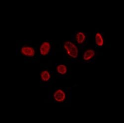 Invitrogen TIA-1 Polyclonal Antibody 100 &mu;L; Unconjugated:Antibodies,