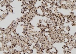 Invitrogen TIA-1 Polyclonal Antibody 100 &mu;L; Unconjugated:Antibodies,
