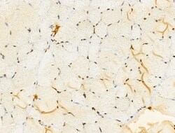 Invitrogen TIA-1 Polyclonal Antibody 100 &mu;L; Unconjugated:Antibodies,