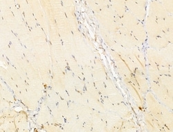 Invitrogen TIA-1 Polyclonal Antibody 100 &mu;L; Unconjugated:Antibodies,