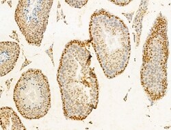Invitrogen TIA-1 Polyclonal Antibody 100 &mu;L; Unconjugated:Antibodies,