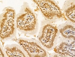 Invitrogen TIA-1 Polyclonal Antibody 100 &mu;L; Unconjugated:Antibodies,