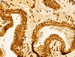 Invitrogen TIA-1 Polyclonal Antibody 100 &mu;L; Unconjugated:Antibodies,