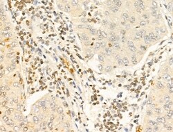 Invitrogen TIA-1 Polyclonal Antibody 100 &mu;L; Unconjugated:Antibodies,