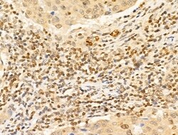 Invitrogen TIA-1 Polyclonal Antibody 100 &mu;L; Unconjugated:Antibodies,