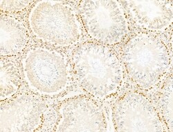 Invitrogen TIA-1 Polyclonal Antibody 100 &mu;L; Unconjugated:Antibodies,