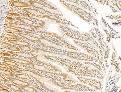 Invitrogen TIA-1 Polyclonal Antibody 100 &mu;L; Unconjugated:Antibodies,