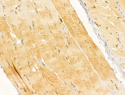 Invitrogen CYLD Polyclonal Antibody 100 &mu;L; Unconjugated:Antibodies,