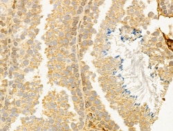 Invitrogen CYLD Polyclonal Antibody 100 &mu;L; Unconjugated:Antibodies,