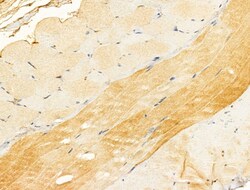 Invitrogen CYLD Polyclonal Antibody 100 &mu;L; Unconjugated:Antibodies,