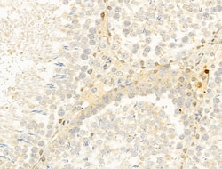 Invitrogen CYLD Polyclonal Antibody 100 &mu;L; Unconjugated:Antibodies,