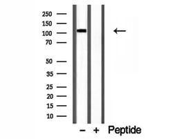 Invitrogen CYLD Polyclonal Antibody 100 &mu;L; Unconjugated:Antibodies,