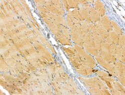 Invitrogen ETFB Polyclonal Antibody 100 &mu;L; Unconjugated:Antibodies,