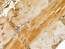 Invitrogen ETFB Polyclonal Antibody 100 &mu;L; Unconjugated:Antibodies,