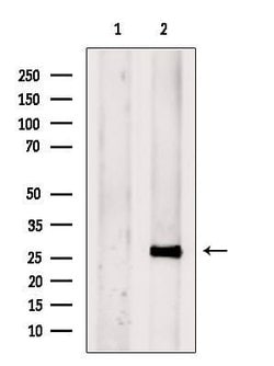 Invitrogen ETFB Polyclonal Antibody 100 &mu;L; Unconjugated:Antibodies,