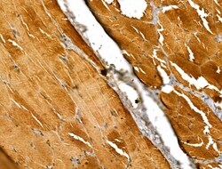 Invitrogen EXOC1 Polyclonal Antibody 100 &mu;L | Buy Online | Invitrogen&trade; | Fisher Scientific