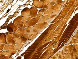 Invitrogen EXOC1 Polyclonal Antibody 100 &mu;L | Buy Online | Invitrogen&trade; | Fisher Scientific