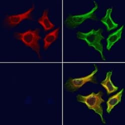 Invitrogen P4HA1 Polyclonal Antibody 100 &mu;L; Unconjugated:Antibodies,