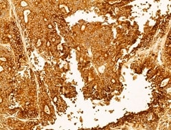 Invitrogen P4HA1 Polyclonal Antibody 100 &mu;L; Unconjugated:Antibodies,