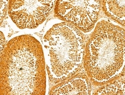 Invitrogen P4HA1 Polyclonal Antibody 100 &mu;L; Unconjugated:Antibodies,