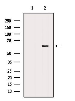 Invitrogen P4HA1 Polyclonal Antibody 100 &mu;L; Unconjugated:Antibodies,