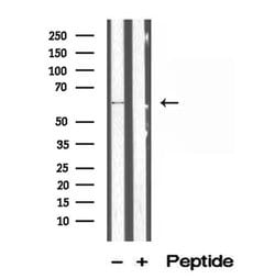 Invitrogen P4HA1 Polyclonal Antibody 100 &mu;L; Unconjugated:Antibodies,
