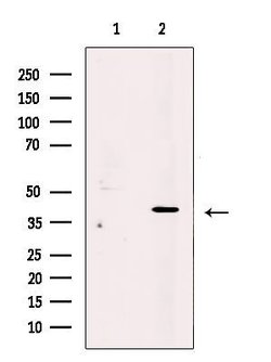 Invitrogen PRPH2 Polyclonal Antibody 100 &mu;L | Buy Online | Invitrogen&trade; | Fisher Scientific