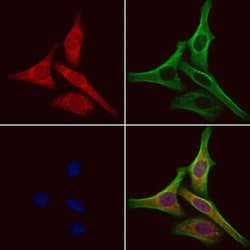 SRP9 Polyclonal Antibody 100 &mu;L | Buy Online | Invitrogen | Fisher Scientific