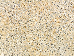 SRP9 Polyclonal Antibody 100 &mu;L | Buy Online | Invitrogen | Fisher Scientific
